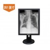 安立信PACS閱片醫用顯示器